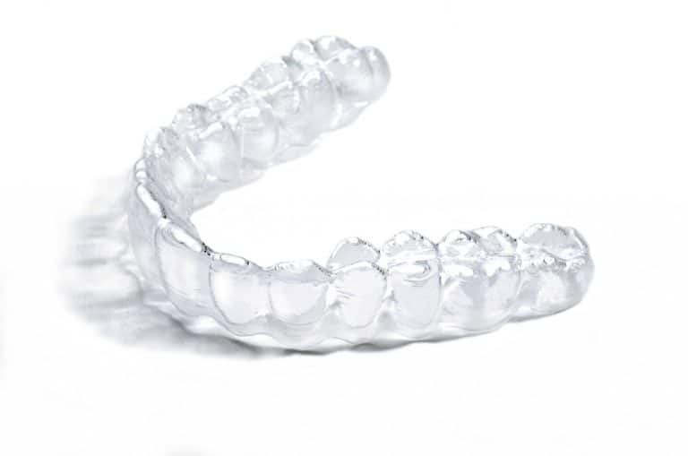 invisalign-clear-aligners
