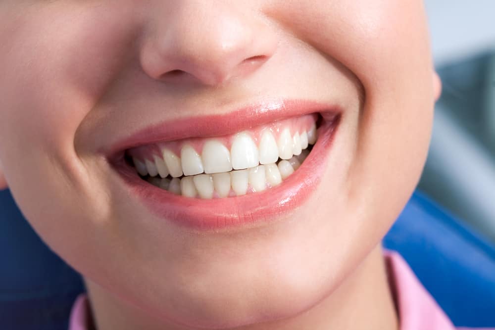 How Long Does Teeth Sensitivity Last After Whitening?