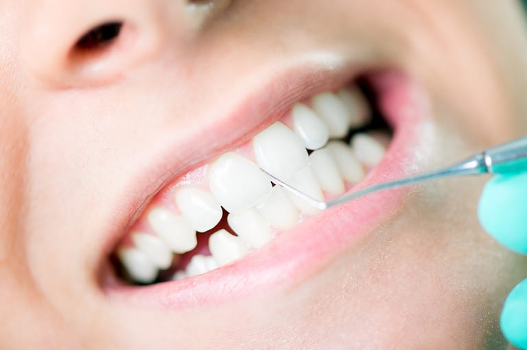 Dental Cleaning Unveiled: How Much Time Should You Allocate?
